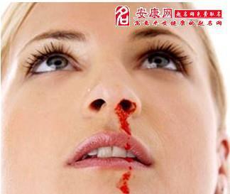 梦见自己的鼻子流血有什么预兆?是什么意思? 女人梦见自己鼻子流血