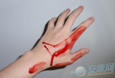 梦见自己的手指头流血有什么预兆?是什么意思? 做梦出血什么预兆