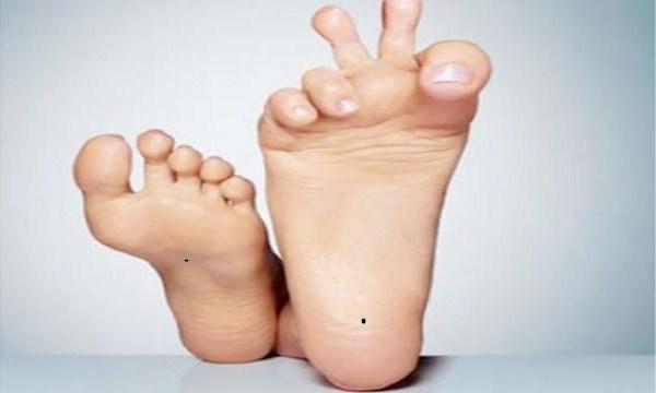 脚上有痣代表什么 女人左脚底有痣全图解